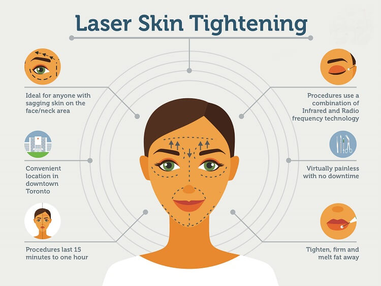 Infrared Lasers for Skin Tightening