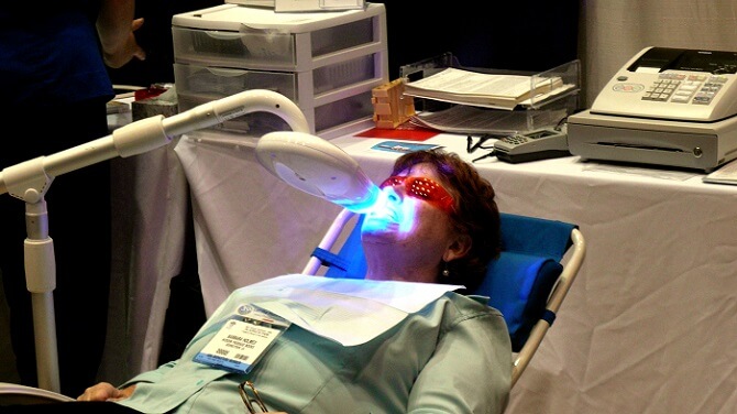 laser Teeth Whitening